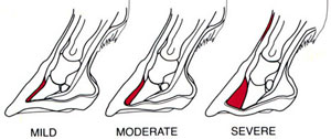 laminitis